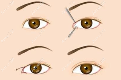 吕方中的口碑到底如何?据说吕方中负评新消息口碑已经逆转,都说修复的比较无痕、自然