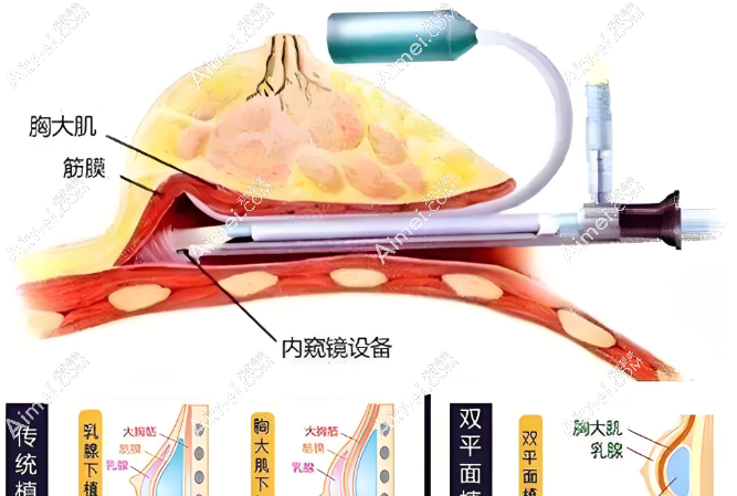 如何获取附近隆胸医院的热线电话 如何获取附近隆胸医院的热线电话