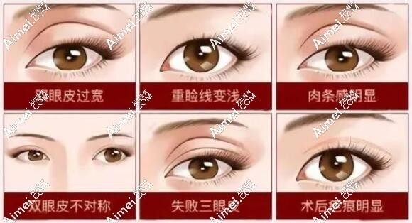 北京嘉禾孙景波修复双眼皮怎么样 北京嘉禾孙景波修复双眼皮怎么样