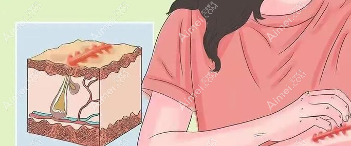 rt100淺放哪個(gè)醫(yī)院有?廣東|山東|重慶|北京等50+有rt100淺放儀器的醫(yī)院名單公布