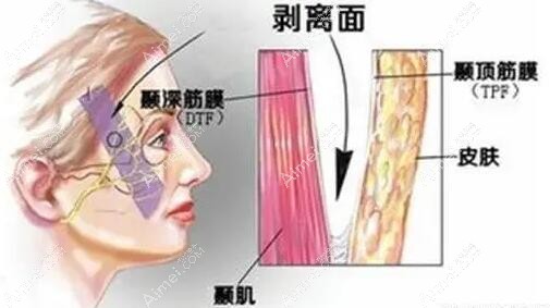 北京杨喆拉皮技术怎么样呢？杨喆在北京四季青橙医院做小拉皮技术好-价格68000元起