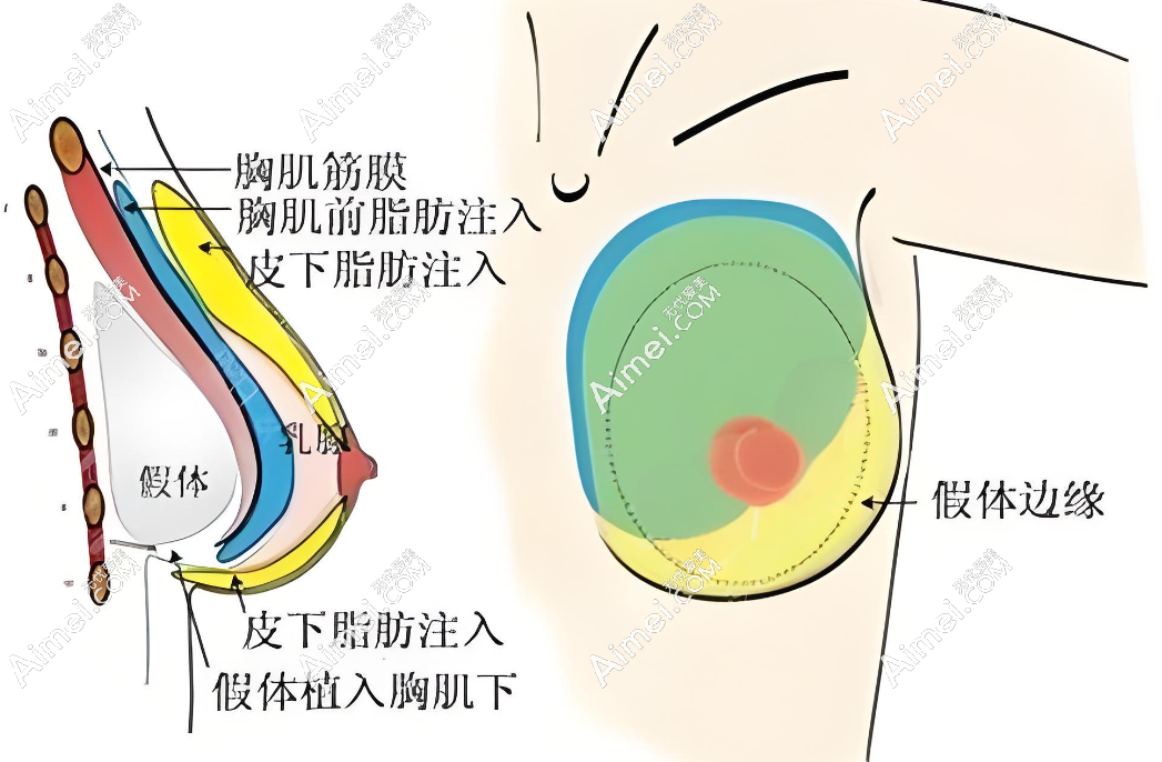 沈正宇医生预约挂号www.aimei.com