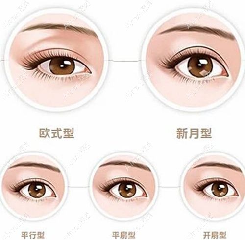 米蘭柏羽做雙眼皮比較好的醫(yī)生排名,成都總院+北京/深圳/重慶/西安分院雙眼皮醫(yī)生可查詢