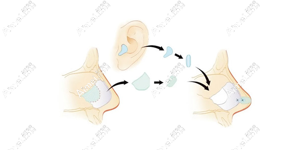 成都李叢叢醫(yī)生簡介:成都市八大處李叢叢醫(yī)生隆鼻簡介信息全覽  
