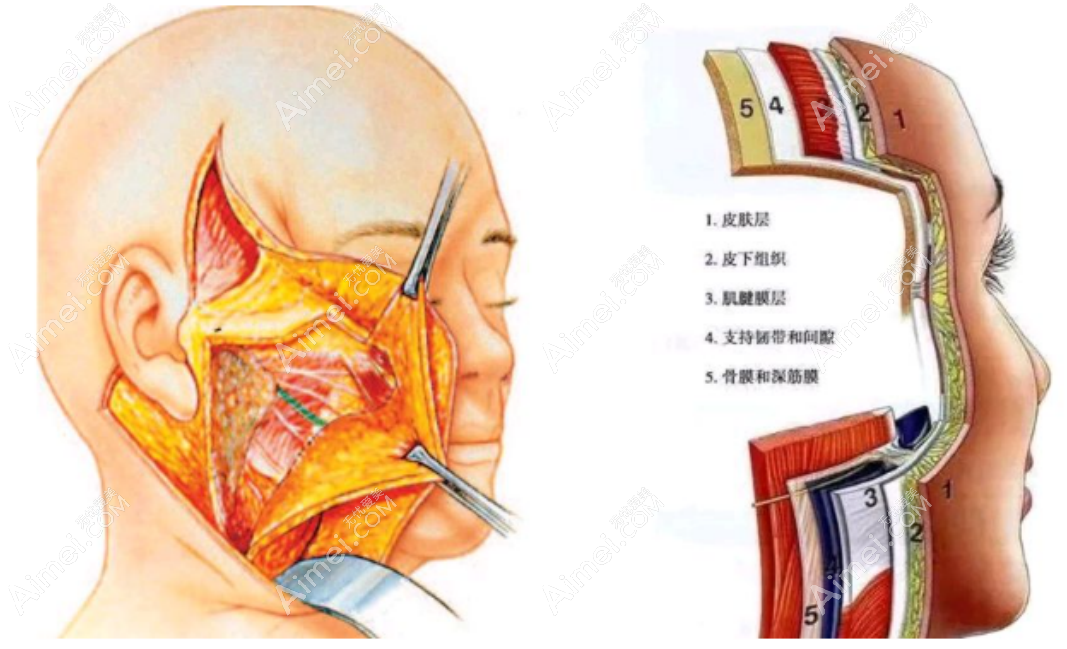 高亚东医生的拉皮手术经验