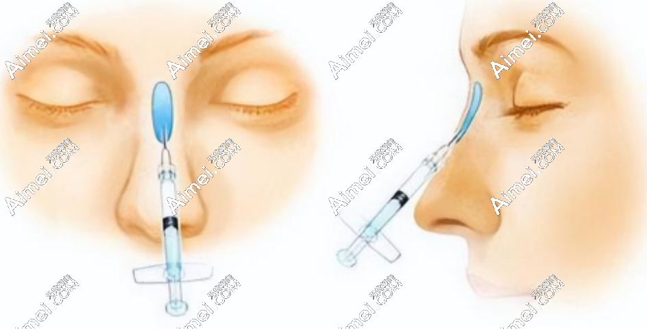 太原伊禾医疗美容注射