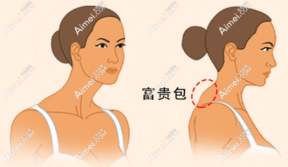 aimei.com太原黄学峰富贵包