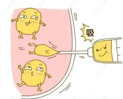 成都王欣吸脂怎么样？王欣做魔塑面吸/威塑体雕等吸脂手术水平高，口碑好受欢迎！