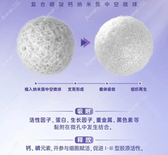 悦龄塑注射填充的优势