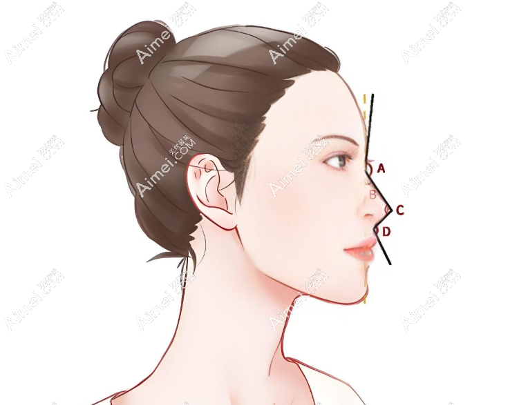 上海做網(wǎng)紅鼻子比較好的醫(yī)生排名前十頂牛榜,范榮杰/沈國雄/李健前三無爭(zhēng)議