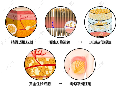 贵阳隆胸有名的医生 贵阳隆胸有名的医生
