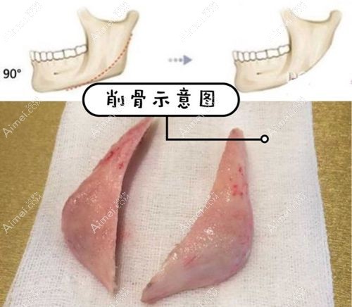 李献和磨骨很靠谱