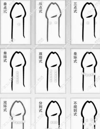 别再花冤枉钱！男科医院男性入珠手术在线问诊0元享
