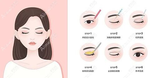 張瑩瑩個人簡歷與成就匯總，張瑩瑩50多歲了做雙眼皮醫(yī)術(shù)好，鮮有失敗實例