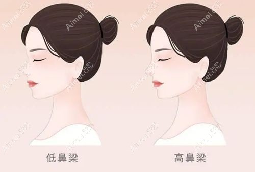 北京冯雁平鼻子做得好纯口碑无营销，分享冯雁平鼻子成功实例若干供参考