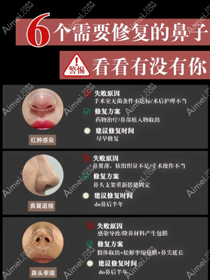 北京鼻修复www.aimei.com 北京鼻修复www.aimei.com