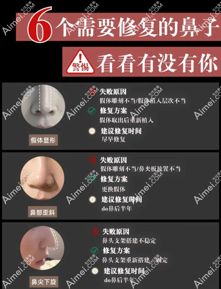 【2025年北京鼻修复医院排名前十名】术后鼻型“美到犯规”，整友：这10家后悔没早做！