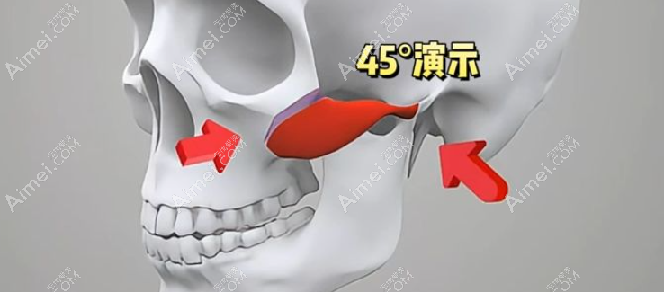 重慶磨骨好的醫(yī)生