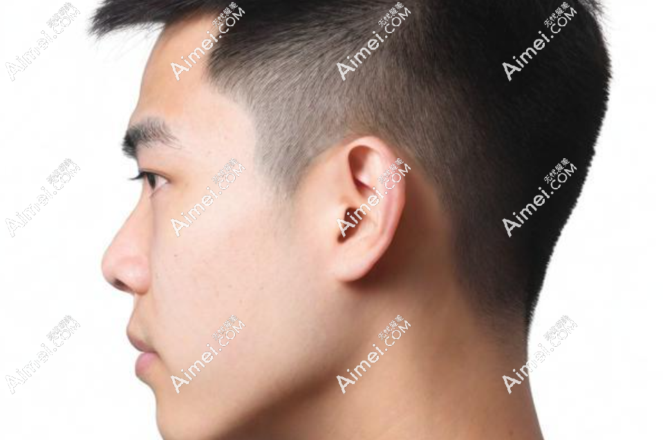 成都耳朵整形医生前top 6助你逆袭！段伟强、于晓波等六大医生全解析，耳畸形不再怕！