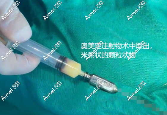 周云超取奧美定評(píng)價(jià)