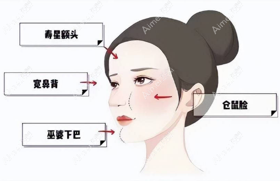 成都修復(fù)面部饅頭化好的醫(yī)生推薦：謝雯、朱慧東等是成都饅頭臉修復(fù)好的排名前十醫(yī)生
