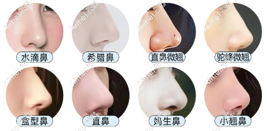 王军鼻子实例图片 王军鼻子实例图片
