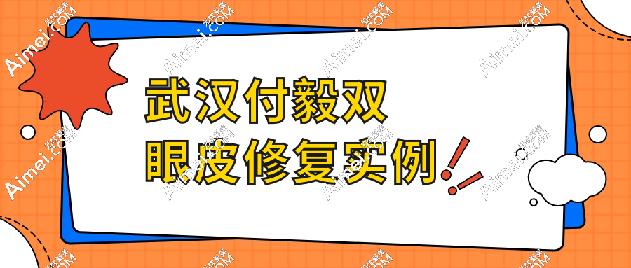 武汉付毅双眼皮修复实例