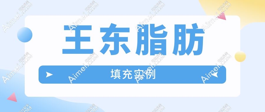 王东脂肪填充实例