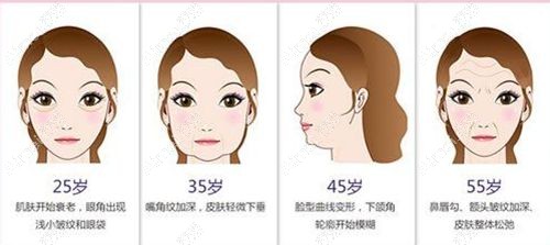 2025国内做拉皮手术有名的医生排名榜：北有王志军，南有黄广香，都是做高位SMAS拉皮大佬级人物