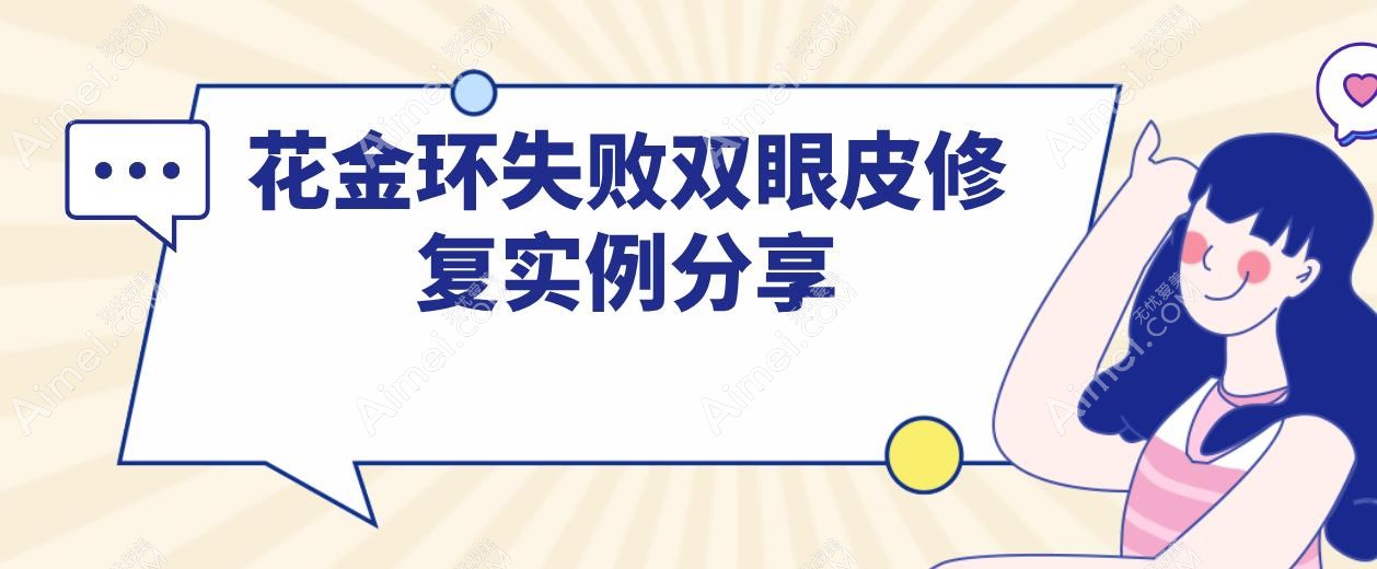 花金环失败双眼皮修复实例:微创无痕修复术+个性化调整,闭眼无痕睁眼有神!