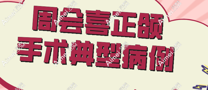 周会喜正颌手术典型病例 周会喜正颌手术典型病例