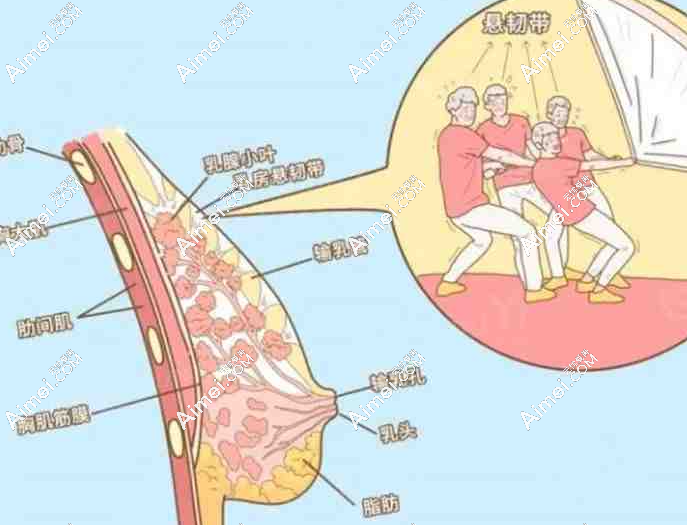2025胸部韧带提升术价格揭秘：轻中度5千起，重度5万起