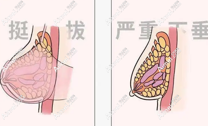 2025胸部韧带提升术价格揭秘：成都/上海/杭州价差3倍，轻度下垂5千起，重度胸部韧带提升5万起