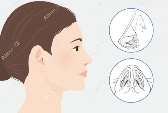 北京刘彦军做鼻子怎么预约