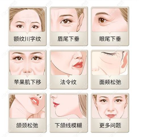 王召东的筋膜固定是正规的吗