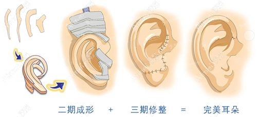 2025郭树忠医生联系方式：通过电话/微信联系深圳和睦家郭树忠院长更容易