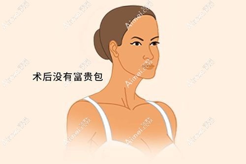 富贵包手术3.jpg