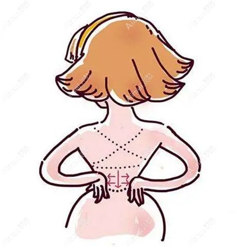深圳今喜医疗美容门诊部是公立还是私立？正规私立医院，院长是土麦森吸脂研发人曹孟君