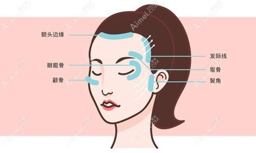 武汉眼周筋膜提升哪个医院做的好？武汉眼周筋膜提升好的医院是艺星/同济/美莱（含收费标准）