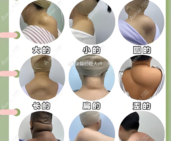 各种形状的富贵包