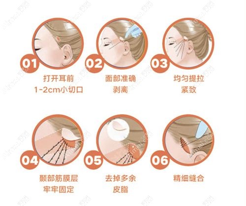 上海拉皮手术医生排名前十名