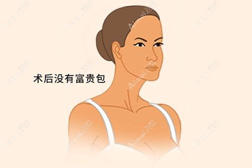 黄学峰一针去富贵包真实实例