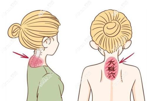 黃學峰一針去富貴包是不是坑人？黃學峰一針去富貴包太貴，一針39800起是否暗藏騙局？