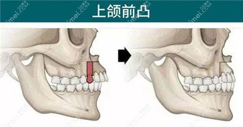 罗恩医生患者口碑与真实实例