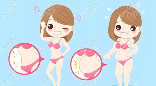北京冯斌医生吸脂为何那么贵？脂雕vs普通吸脂：手工分层吸脂+体内提纯，成活率高达85%