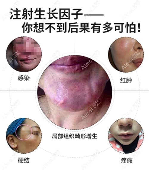 上海取生長因子口碑好的醫(yī)院推薦！排名前五，技術(shù)靠譜，取出干凈又安心
