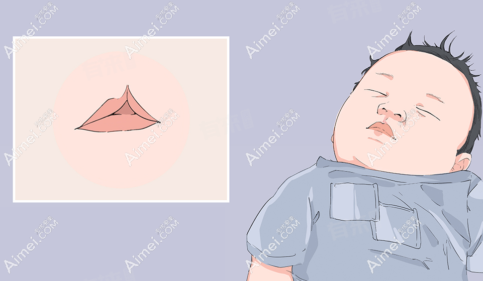 預(yù)約石冰唇裂修復(fù)手術(shù)