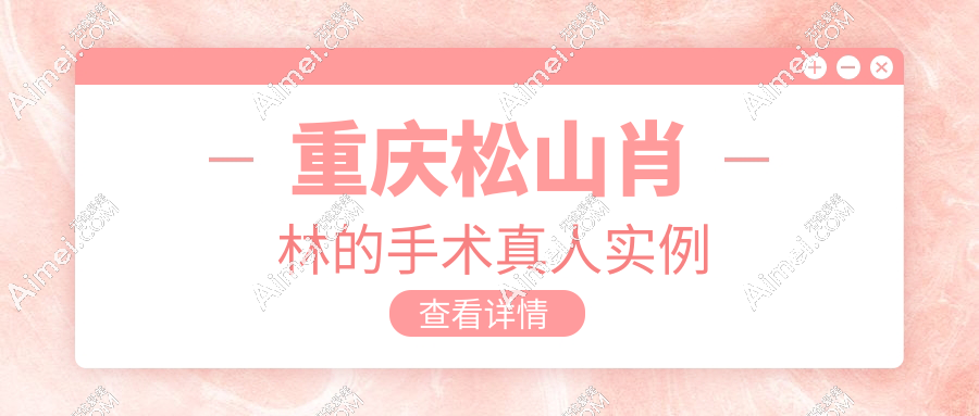 重庆松山肖林的手术真人实例