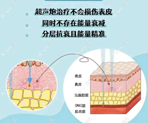 汕头超声炮做的好的医院 汕头超声炮做的好的医院