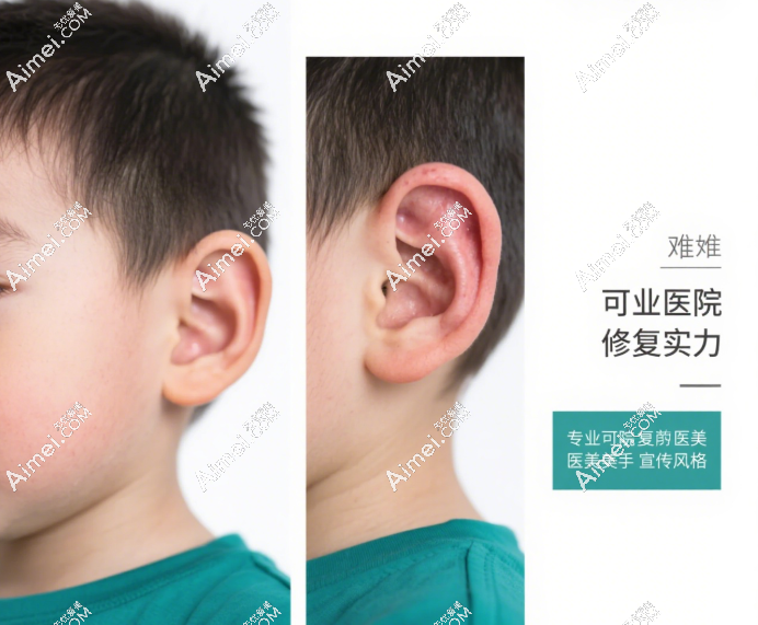 从残缺耳廓到自然再造的真实蜕变 从残缺耳廓到自然再造的真实蜕变
